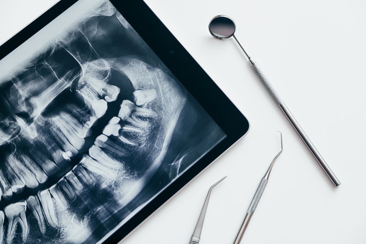 OPG radiograph on a tablet with dental instruments